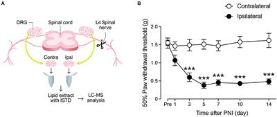 Profiling of fatty acid metabolism in the dorsal root ganglion after peripheral nerve injury